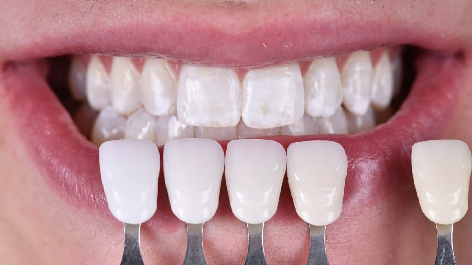 Advanced Dental Tech